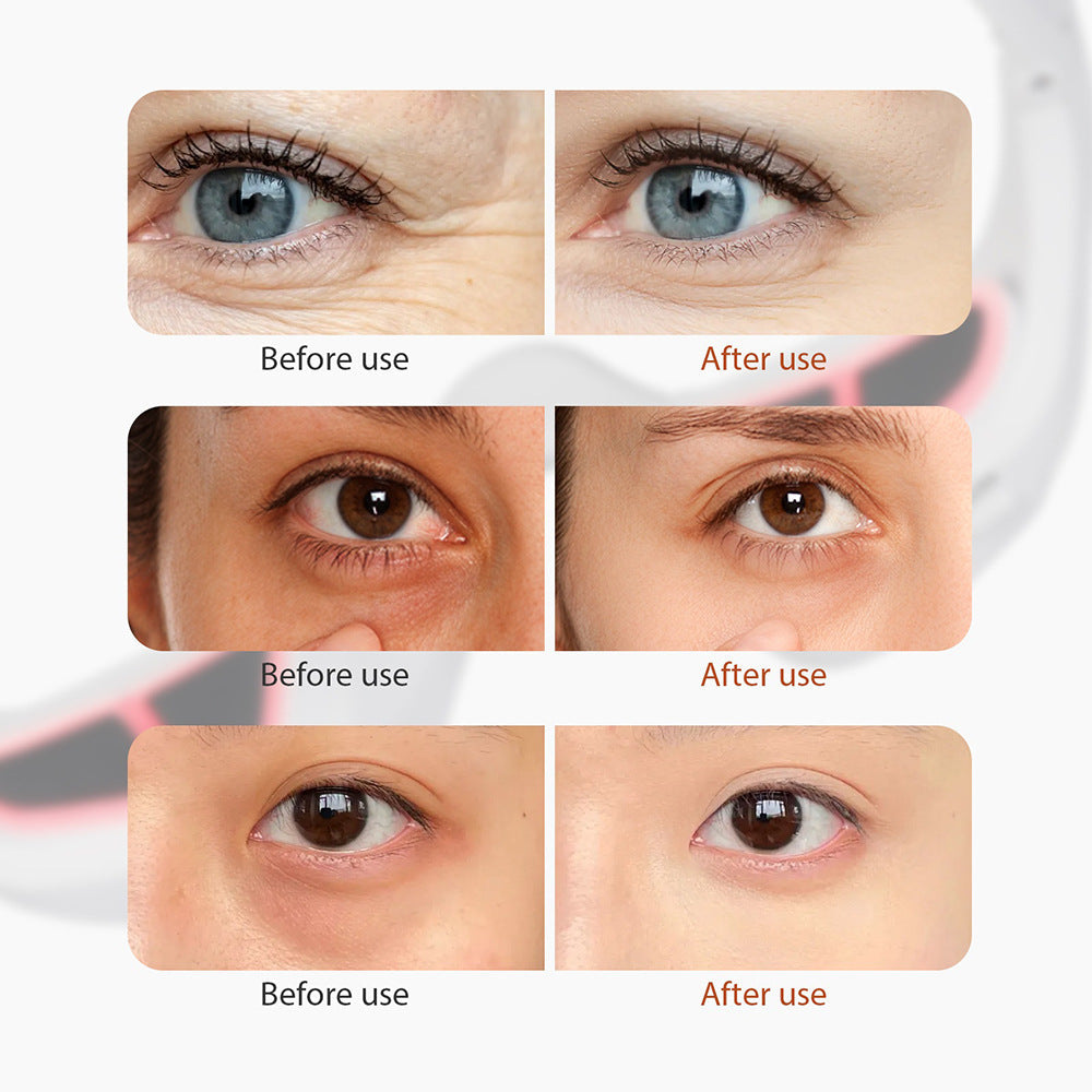 Bright Eyes, Confident You –  Eye Massager with Red Light Therapy